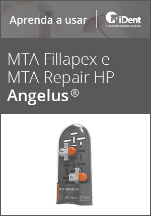Cover for Aprenda a usar: MTA Fillapex e MTA Repair HP da Angelus