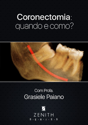 Cover for Coronectomia: Quando e como?