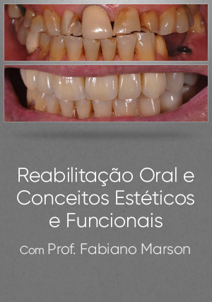 Cover for Reabilitação Oral e Conceitos Estéticos e Funcionais
