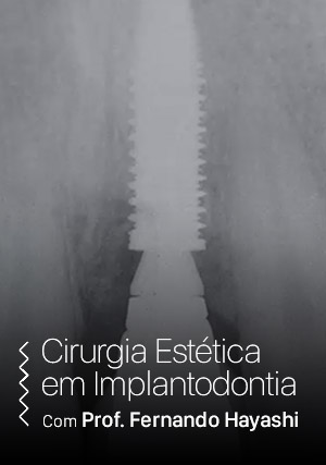 Cover for Cirurgia Estética em Implantodontia