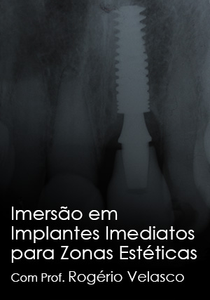 Cover for Imersão em Implantes Imediatos em Zonas Estéticas