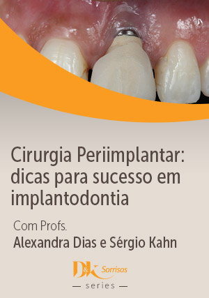 Cover for Cirurgia Periimplantar: Dicas para Sucesso em Implantodontia