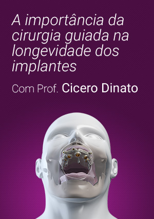 Cover for A Importância da Cirurgia Guiada na Longevidade dos Implantes