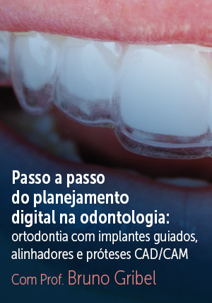 Cover for Passo a Passo do Planejamento Digital na Odontologia: Ortodontia com Alinhadores, Implantes Guiados e Próteses CAD/CAM