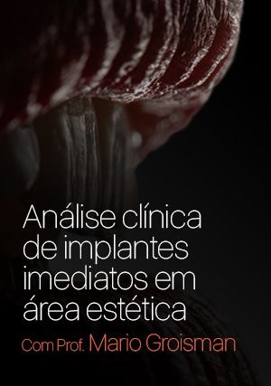 Cover for Análise Clínica de Implantes Imediatos em Área Estética