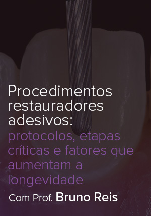 Cover for Procedimentos Restauradores Adesivos: Protocolos, Etapas Críticas e Fatores que Aumentam a Longevidade