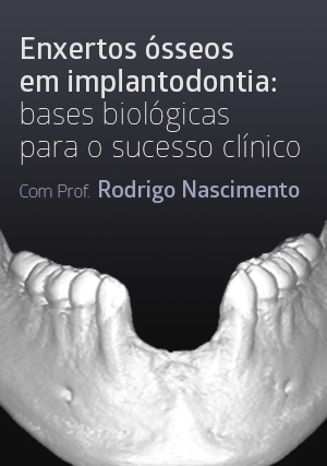 Cover for Enxertos Ósseos em Implantodontia: Bases Biológicas para o Sucesso Clínico