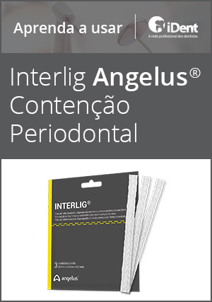 Cover for Aprenda a usar: Interlig Angelus Contenção Periodontal