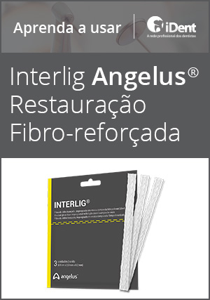 Cover for Aprenda a usar: Interlig Angelus Restauração Fibro-reforçada