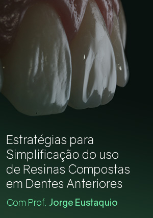 Cover for Estratégias para Simplificação do uso de Resinas Compostas em Dentes Anteriores