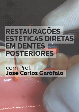 Cover for Hands On: Restaurações Estéticas Diretas em Dentes Posteriores