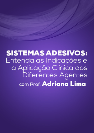 Cover for Sistemas Adesivos: Entenda as Indicações e a Aplicação Clínica dos Diferentes Agentes