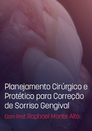 Cover for Planejamento Cirúrgico e Protético para Correção de Sorriso Gengival