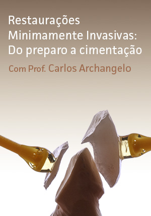 Cover for Restaurações Minimamente Invasivas: Do Preparo a Cimentação