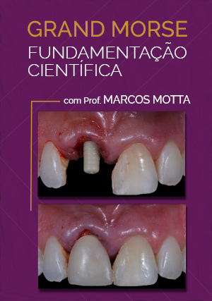 Cover for Grand Morse Fundamentação Científica