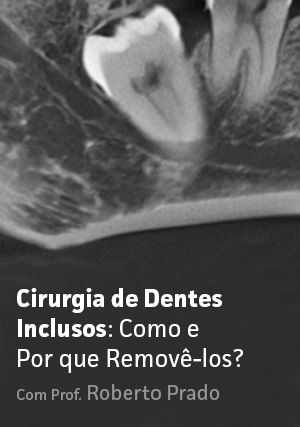 Cover for Cirurgia de Dentes Inclusos: Como e Por que Removê-los?