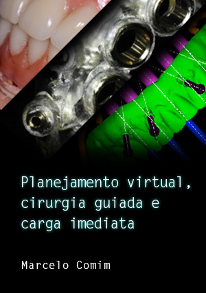 Cover for Planejamento Virtual, Cirurgia Guiada e Carga Imediata