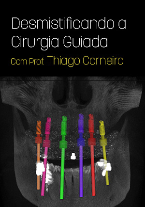 Cover for Desmistificando a Cirurgia Guiada