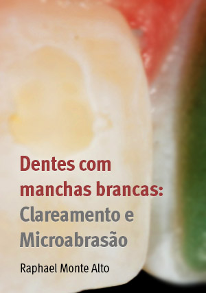 Cover for Dentes com Manchas Brancas: Clareamento e Microabrasão