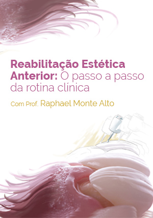 Cover for Reabilitação Estética Anterior: O passo a passo da rotina clínica