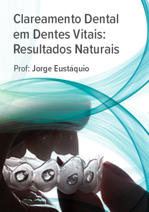 Cover for Clareamento Dental em Dentes Vitais: Resultados Naturais