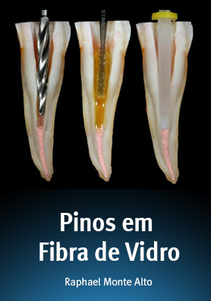 Cover for Pinos em Fibra de Vidro