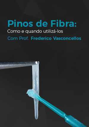Cover for Pinos de Fibra: Como e Quando Utilizá-los