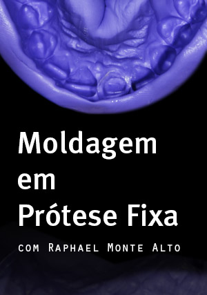 Cover for Moldagem em Prótese Fixa