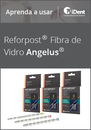Cover for Aprenda a usar: Reforpost Fibra De Vidro Angelus