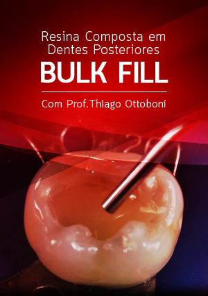 Cover for Bulk Fill: Resina Composta em Dentes Posteriores