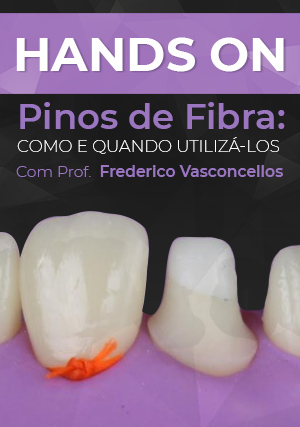 Cover for Hands On Pinos de Fibra: Como e Quando Utilizá-los