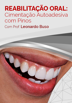 Cover for Reabilitação Oral: Cimentação de Pinos Estéticos