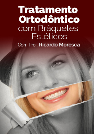 Cover for Tratamento Ortodôntico com Bráquetes Estéticos