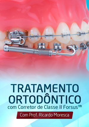 Cover for Tratamento Ortodôntico com Corretor de Classe II Forsus