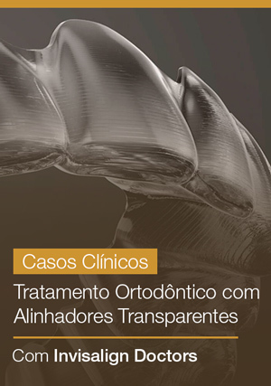 Cover for Casos Clínicos - Tratamento Ortodôntico com Alinhadores Transparentes