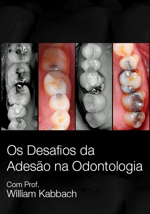 Cover for Os Desafios da Adesão na Odontologia