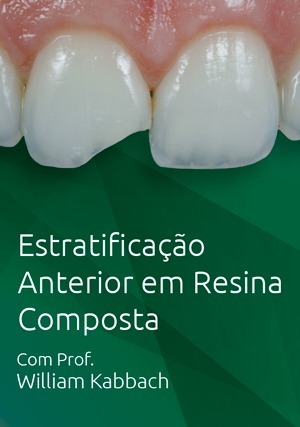 Cover for Estratificação Anterior em Resina Composta