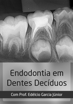 Cover for Endodontia em Dentes Decíduos