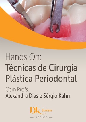 Cover for Hands On Técnicas de Cirurgia Plástica Periodontal