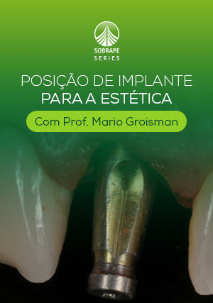 Cover for Posição de Implante para a Estética