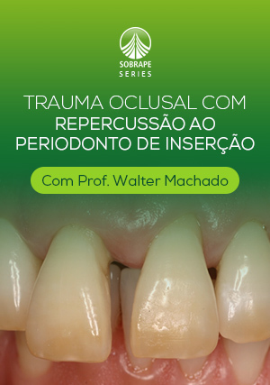Cover for Trauma Oclusal com Repercussão ao Periodonto de Inserção