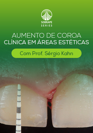 Cover for Aumento de Coroa Clínica em Áreas Estéticas