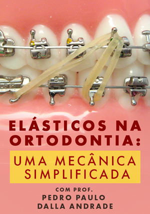 Cover for Elásticos na Ortodontia: uma Mecânica Simplificada