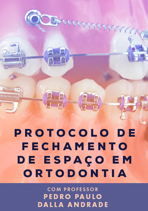Cover for Protocolo de Fechamento de Espaço em Ortodontia