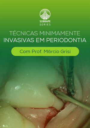 Cover for Técnicas Minimamente Invasivas em Periodontia