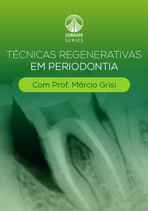 Cover for Técnicas Regenerativas em Periodontia