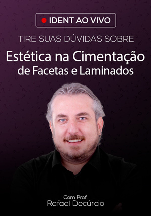 Cover for Tire Suas Dúvidas Sobre Estética na Cimentação de Facetas e Laminados