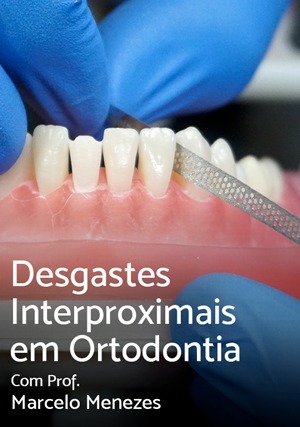 Cover for Desgastes Interproximais em Ortodontia