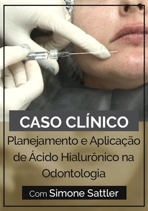 Cover for Caso Clínico - Planejamento e Aplicação de Ácido Hialurônico na Odontologia