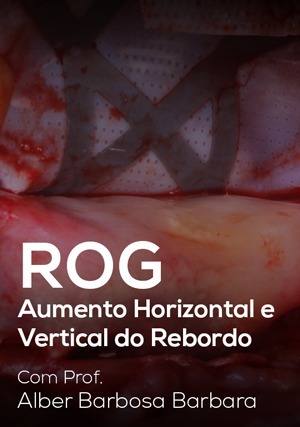 Cover for ROG - Aumento Horizontal e Vertical do Rebordo